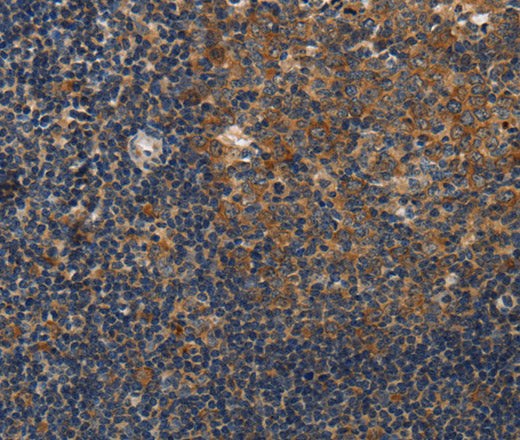 DSP Polyclonal Antibody – Figure 1 of 3