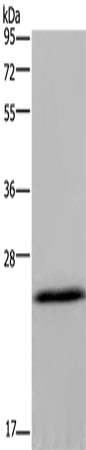 KCNMB4 Polyclonal Antibody – Figure 1 of 4
