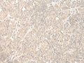 HENMT1 Polyclonal Antibody – Figure 1 of 2