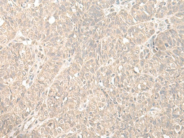 HENMT1 Polyclonal Antibody – Figure 1 of 2