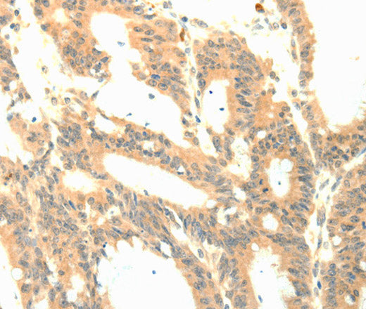 P23 Polyclonal Antibody – Figure 1 of 2