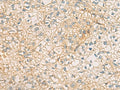 MRPL9 Polyclonal Antibody – Figure 1 of 2