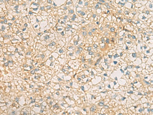 MRPL9 Polyclonal Antibody – Figure 1 of 2