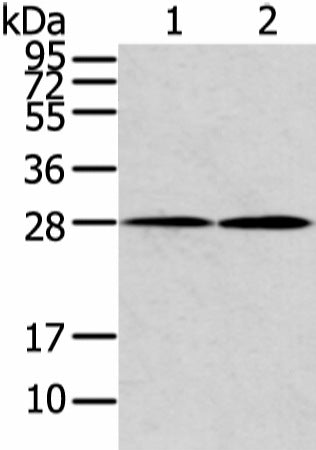 KCNMB1 Polyclonal Antibody – Figure 1 of 2