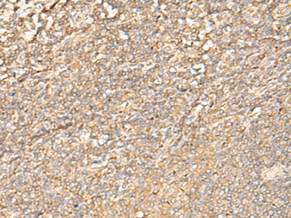 EIF3C Polyclonal Antibody – Figure 1 of 3