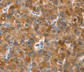 NOD2 Polyclonal Antibody – Figure 1 of 3