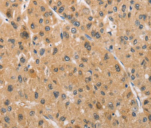 ARMCX1 Polyclonal Antibody – Figure 1 of 3