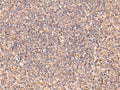 UBAC1 Polyclonal Antibody – Figure 1 of 3