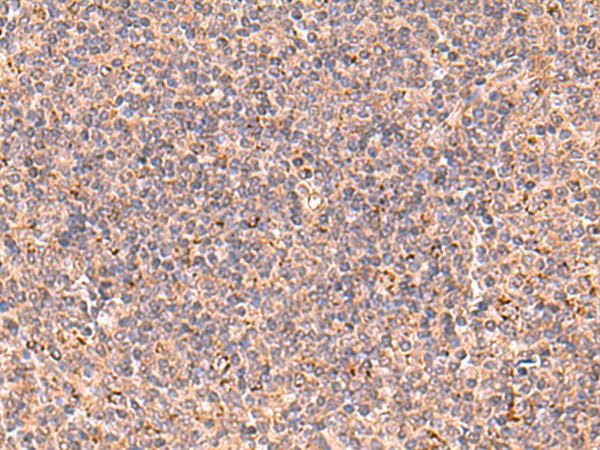 UBAC1 Polyclonal Antibody – Figure 1 of 3