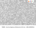 Acral Lentiginous Melanoma Cell Line - (HBL (MM001)) | Applied Biological Materials (abm)