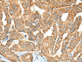 C1R Polyclonal Antibody – Figure 1 of 2