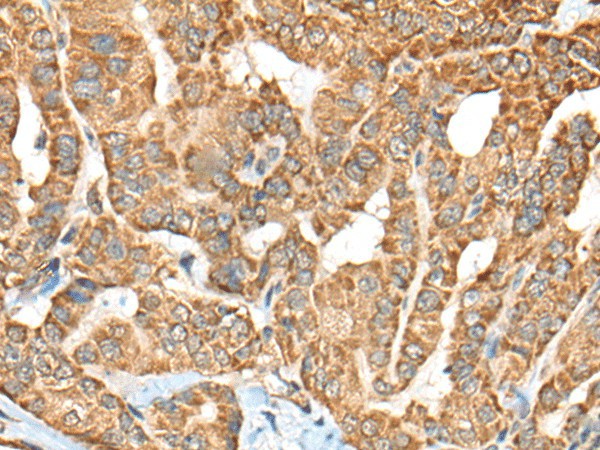 C1R Polyclonal Antibody – Figure 1 of 2
