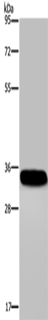 CA4 Polyclonal Antibody – Figure 1 of 4