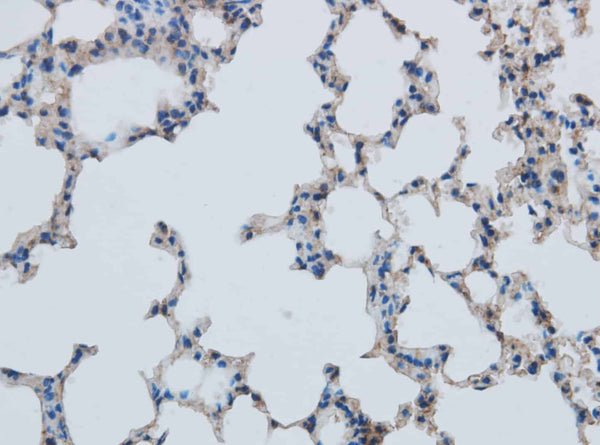 MMP1 Polyclonal Antibody – Figure 1 of 3