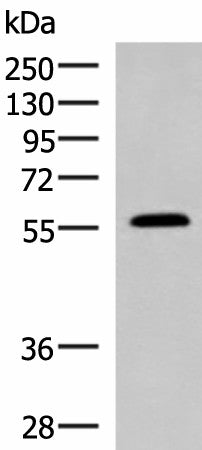 PEPD Polyclonal Antibody – Figure 1 of 3
