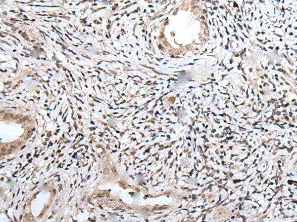 UBN1 Polyclonal Antibody – Figure 1 of 3