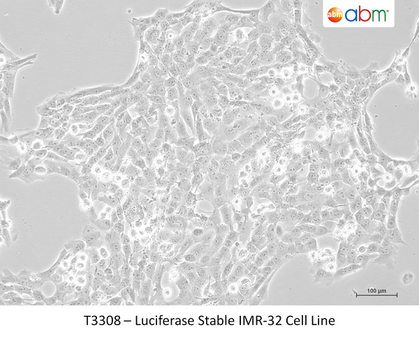 SK-N-AS Stably Overexpresisng THAP1 L180S  - Clone 8 – Figure 1 of 1