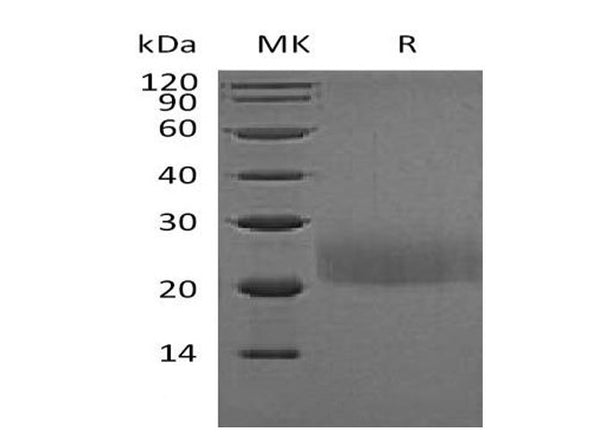 Recombinant Mouse CTLA4 Protein (Flag Tag) – Figure 1 of 2