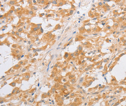 CDKN2AIP Polyclonal Antibody – Figure 1 of 2