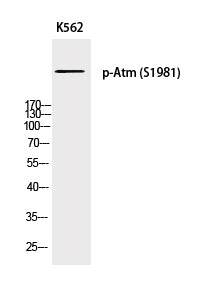 Phospho-ATM (Ser1981) Polyclonal Antibody – Figure 1 of 2