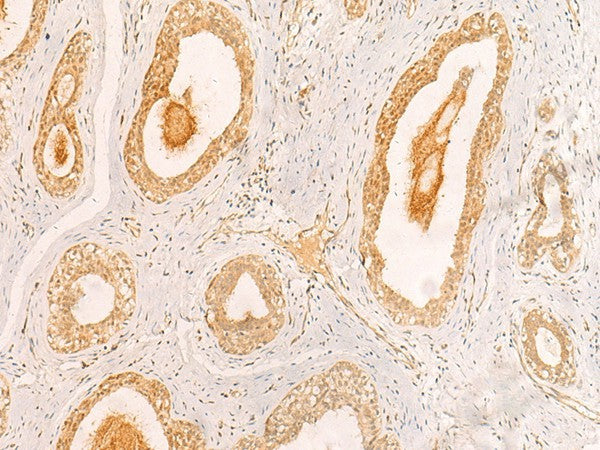 ZNF580 Polyclonal Antibody – Figure 1 of 2