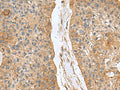 MARCKSL1 Polyclonal Antibody – Figure 1 of 3
