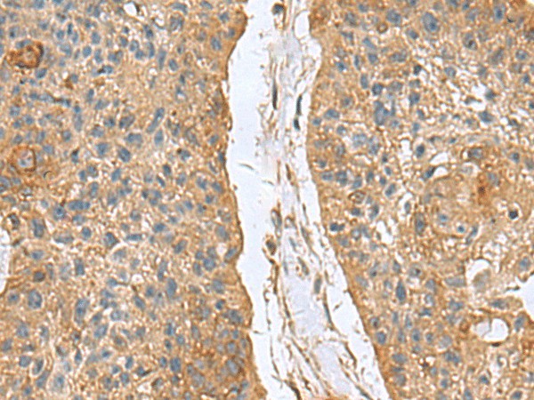 MARCKSL1 Polyclonal Antibody – Figure 1 of 3