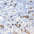 CD19 Polyclonal Antibody – Figure 1 of 4