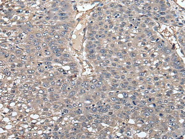 GCNT2 Polyclonal Antibody – Figure 1 of 2