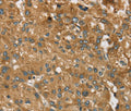 RPS6KA2 Polyclonal Antibody – Figure 1 of 3