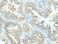 SHTN1 Polyclonal Antibody – Figure 1 of 3