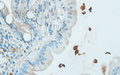 G. lamblia trophozoites on the intestinal surface detected with anti-Giardin α-1 (DB 319), 40x magnification, IHC.