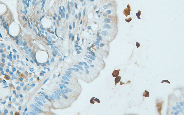 G. lamblia trophozoites on the intestinal surface detected with anti-Giardin α-1 (DB 319), 40x magnification, IHC.