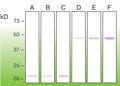 Western blot of bax in mouse brain (A), rat brain (B), HEK293 (C); GST-bax recombinant at 100/200/500 ng (D–F), anti-bax (DB 123).