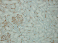 Transplanted kidney with diffuse C4d staining of peritubular and glomerular capillaries (antibody-mediated rejection), anti-C4d (DB 107).