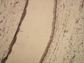 Actin expression in mesenteric vein detected with anti-β-actin (DB001) monospecific antibody, IHC on human tissue.