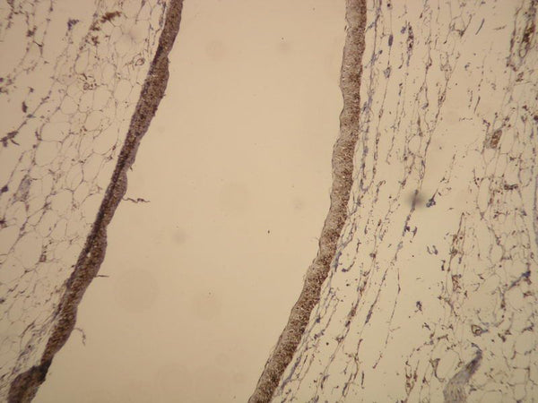 Actin expression in mesenteric vein detected with anti-β-actin (DB001) monospecific antibody, IHC on human tissue.