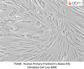 Human Primary Friedriech's Ataxia (FA) Fibroblast Cell Line 4090 – Figure 1 of 1