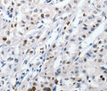 HSPA1A Polyclonal Antibody – Figure 1 of 2
