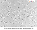 Immortalized Human Fetal Liver Cells (cBAL111) | Applied Biological Materials (abm)