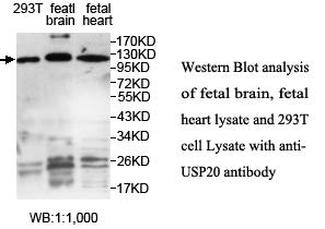 Anti-USP20 Antibody – Figure 1 of 1