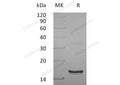 Recombinant Human Interferon γ/IFNG Protein – Figure 1 of 2