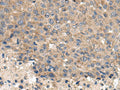 CD59 Polyclonal Antibody – Figure 1 of 2