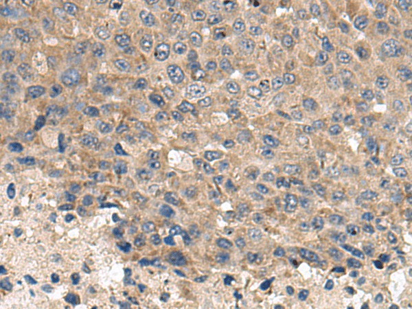 CD59 Polyclonal Antibody – Figure 1 of 2