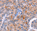 ELP2 Polyclonal Antibody – Figure 1 of 3