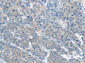 CITED4 Polyclonal Antibody – Figure 1 of 2