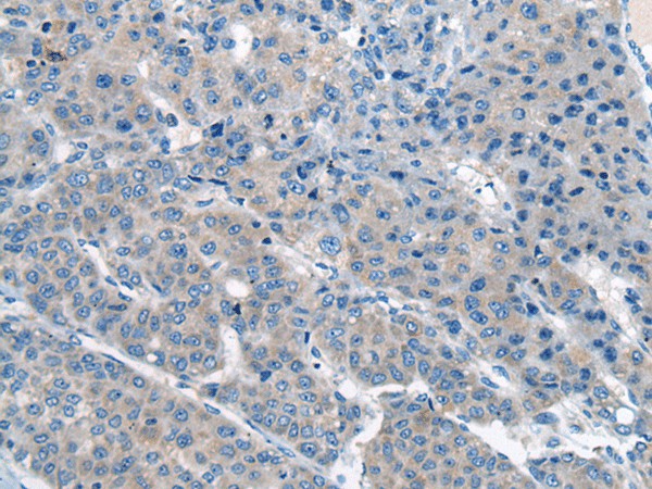 CITED4 Polyclonal Antibody – Figure 1 of 2