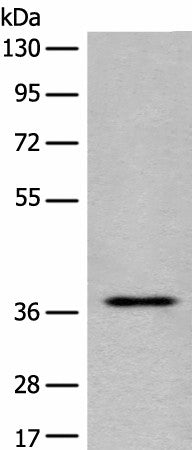 EN2 Polyclonal Antibody – Figure 1 of 2