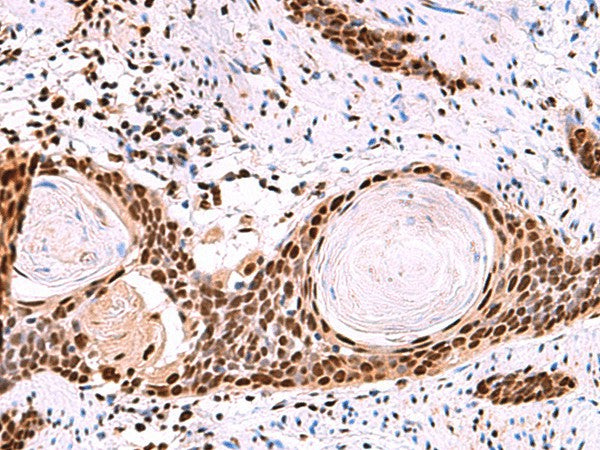 SF3B3 Polyclonal Antibody – Figure 1 of 3