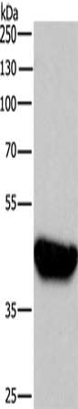 BABAM2 Polyclonal Antibody – Figure 1 of 4